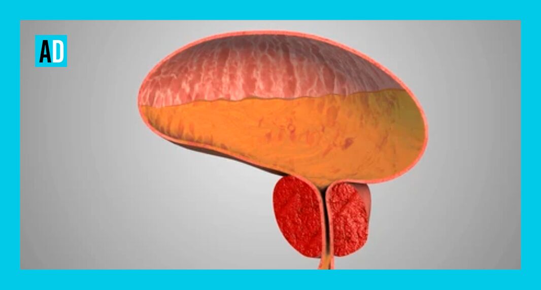 Iekaisis prostatas dziedzeris